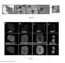 Fig. 07 - Isolation, expansion and characterization of wharton's jelly mesenchymal stem cells