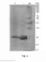 Fig. 05 - Novel 7beta-Hydroxysteroid Dehydrogenases and Their Use