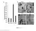 Fig. 05 - Anaplastic Lymphoma Kinase (ALK) As An Oncogene Capable Of Transforming Normal Human Cells