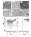 Fig. 06 - Anaplastic Lymphoma Kinase (ALK) As An Oncogene Capable Of Transforming Normal Human Cells