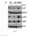 Fig. 09 - Anaplastic Lymphoma Kinase (ALK) As An Oncogene Capable Of Transforming Normal Human Cells