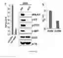 Fig. 14 - Anaplastic Lymphoma Kinase (ALK) As An Oncogene Capable Of Transforming Normal Human Cells