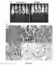 Fig. 16 - Anaplastic Lymphoma Kinase (ALK) As An Oncogene Capable Of Transforming Normal Human Cells