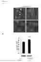 Fig. 15 - Methods for Modulation of Autophagy Through the Modulation of Autophagy-Inhibiting Gene Products