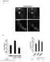 Fig. 19 - Methods for Modulation of Autophagy Through the Modulation of Autophagy-Inhibiting Gene Products