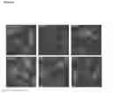Fig. 53 - Methods for Modulation of Autophagy Through the Modulation of Autophagy-Inhibiting Gene Products
