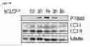 Fig. 79 - Methods for Modulation of Autophagy Through the Modulation of Autophagy-Inhibiting Gene Products