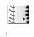 Fig. 13 - Method of enhancing miR-185 expression to reduce low density lipoprotein/cholesterol accumulation in a cell
