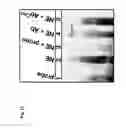 Fig. 14 - Method of enhancing miR-185 expression to reduce low density lipoprotein/cholesterol accumulation in a cell