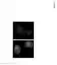 Fig. 05 - Methods of identifying and treating poor prognosis cancers