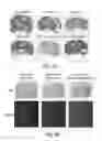 Fig. 03 - Compositions and methods for inhibiting expression of mutant EGFR gene