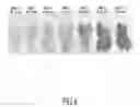 Fig. 05 - CONTROL OF COLD-INDUCED SWEETENING AND REDUCTION OF ACRYLAMIDE LEVELS IN POTATO OR SWEET POTATO