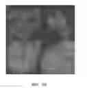 Fig. 72 - LIPID AND GROWTH TRAIT GENES