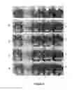 Fig. 04 - Transgenic or non-transgenic plants with mutated protoporphyrinogen oxidase having increased tolerance to herbicides