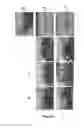 Fig. 07 - Transgenic or non-transgenic plants with mutated protoporphyrinogen oxidase having increased tolerance to herbicides