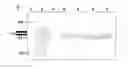 Fig. 09 - RECOMBINANT VIRUS-LIKE PARTICLES ENCODED BY MULTI-GENE VECTOR
