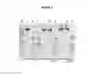 Fig. 06 - Restriction endonucleases and their uses