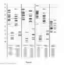 Fig. 07 - DIAGNOSTIC METHOD FOR PREDICTING RESPONSE TO TNFalpha INHIBITOR