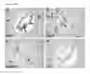 Fig. 02 - Biomarkers for predicting relapse in multiple sclerosis