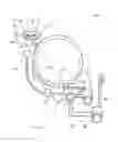 Fig. 11 - Method for treating laundry in a laundry washing machine and laundry washing machine