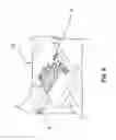 Fig. 09 - Fitting with adjustable restraining area
