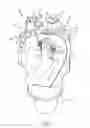 Fig. 02 - Cutting element retention for high exposure cutting elements on earth-boring tools