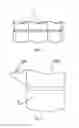 Fig. 02 - Rubber Sleeve Protection Ring and Downhole Plugging Apparatus