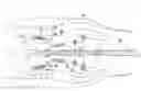 Fig. 01 - Turbine engine guide vane