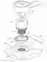 Fig. 01 - Borescope plug for gas turbine engine
