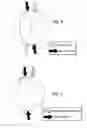 Fig. 10 - Dual-fuel constructions for opposed-piston engines with shaped combustion chambers