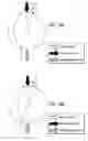 Fig. 11 - Dual-fuel constructions for opposed-piston engines with shaped combustion chambers