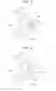Fig. 04 - Spacer