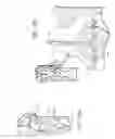 Fig. 11 - Fuel Treatment System and Method