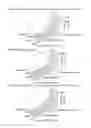 Fig. 04 - Slide bearing