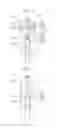 Fig. 07 - CENTRIFUGAL-PENDULUM VIBRATION ABSORBING DEVICE