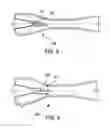 Fig. 05 - Ejector