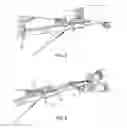 Fig. 04 - Crossbow de-tensioning apparatus