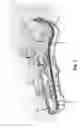 Fig. 08 - Crossbow case including ethylene-vinyl acetate