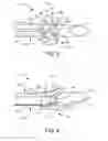 Fig. 03 - Broad head arrow tip and associated methods