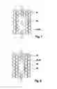 Fig. 05 - Particle sensor and method for manufacturing a particle sensor