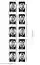 Fig. 25 - MEMS IMPLEMENTATION FOR DETECTION OF WEAR METALS
