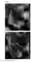 Fig. 02 - Corneodesomosomes and barrier function maturation