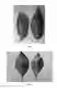 Fig. 05 - Rapid diagnosis method of citrus huanglongbing