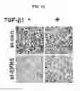 Fig. 12 - METHOD FOR SCREENING EMT INHIBITOR