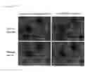 Fig. 02 - METHOD FOR DETECTING PROSTATIC BASAL CELLS