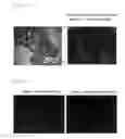 Fig. 03 - METHOD FOR DETECTING PROSTATIC BASAL CELLS