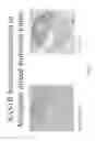 Fig. 06 - COMPOSITIONS AND METHODS FOR DETECTING, DIAGNOSING, AND TREATING CANCER