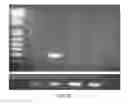 Fig. 33 - COMPOSITIONS AND METHODS FOR DETECTING, DIAGNOSING, AND TREATING CANCER