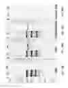 Fig. 38 - COMPOSITIONS AND METHODS FOR DETECTING, DIAGNOSING, AND TREATING CANCER
