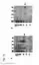 Fig. 13 - Identification of tumor-associated cell surface antigens for diagnosis and therapy